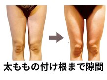 ニュートラル 池袋店(NEUTRAL)/施術結果【痩身/筋膜】