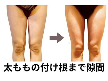 ニュートラル 池袋店(NEUTRAL)/施術結果【痩身/筋膜】