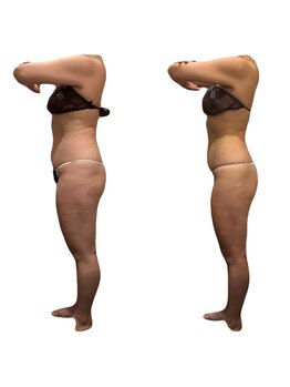 アールユー ギンザ(Ryou ginza)/お腹まわりもスッキリ!