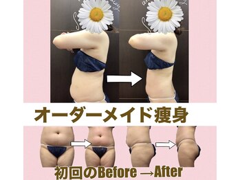 スワン 新栄店(SWAN)/【1週間でー2kgー2%】モニター様