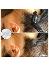 リノア 心斎橋店(LINOAH)/うなじ脱毛（シェービング付）