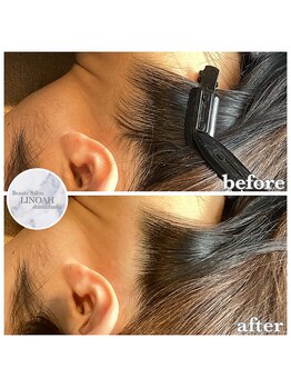 リノア 心斎橋店(LINOAH)/うなじ脱毛(シェービング付)