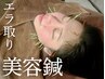 【食いしばり撃退】エラ取り美容鍼×小顔マッサージ×ヘッドスパ×中周波