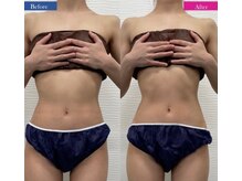 インナーメス(INNER MES)/上半身メインでくびれたお腹に！