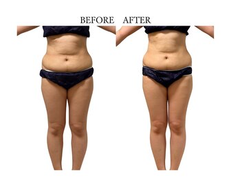 ヨサパーク サノン(YOSA PARK Sanon)/どんどん綺麗な体に！