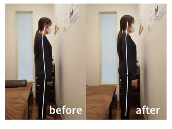 リファイン整体院 国分寺店/姿勢改善、肩こり、腰痛、整体