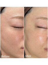 シュ シュ(chou chou)/【セラピール】