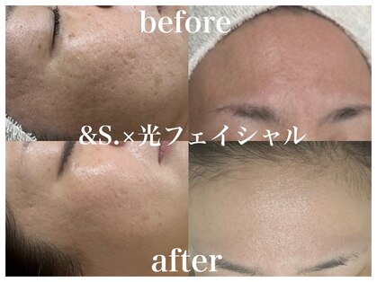 アンドエス(&S.)の写真