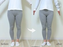 エーアール(AR)/【Before/After】3回目