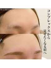 アイル(I'll)/コンプレックス解消