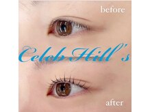 セレブヒルズ 北円山店(Celeb Hill's)/