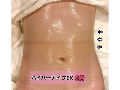 岐阜市のvio脱毛が人気のエステサロン 口コミ人気ランキング ホットペッパービューティー