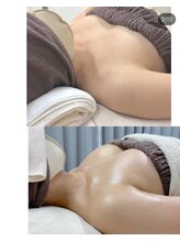 ワイサロン(Y salon)/産後バスト/6ヶ月/E→Fカップ