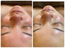 ブラン ネージュ(Blanc Neige)/レストレストリートメント