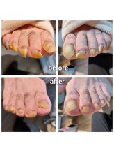 爪切り屋 足楽/爪ケア60分