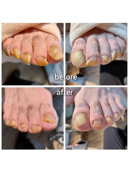 爪切り屋 足楽/爪ケア60分