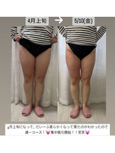 クレール 小山店(CLAIR)/【痩身3ステップ】足バージョン