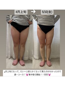 クレール 小山店(CLAIR)/【痩身3ステップ】足バージョン