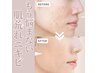 人気No3【最新韓国式肌質改善】LED肌荒れ・ニキビケア/美肌/毛穴洗浄/小顔