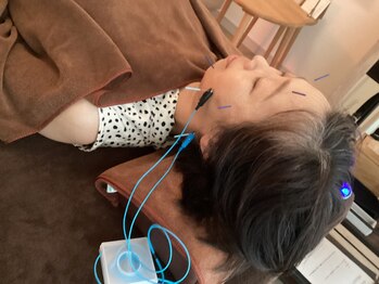 ハリファ鍼灸院 横浜関内院(HariFa鍼灸院)/美容鍼