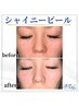 【つや肌】つや玉シャイニーピール/毛穴/くすみ/通常¥18000→¥13200
