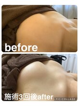 ギンザアール(GINZA R.)/バストアップ◎