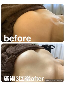 ギンザアール(GINZA R.)/バストアップ◎