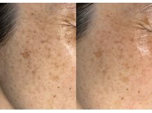 モガナ(mogana)/50代・ぱっと輝くお肌！