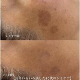 サロンビューティー美優
