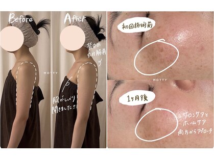 モッティ(MOTTY)の写真