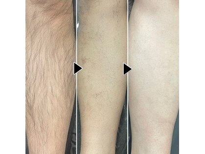 クロズキン 神戸三ノ宮店(Kurozukin)の写真