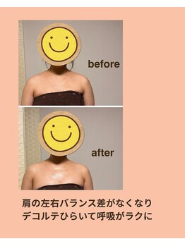 イーズリー(easily)/BEFORE→AFTER