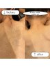 【夏前限定!】首から下ををまるっと脱毛【全身脱毛¥11,000】★☆回数:1回