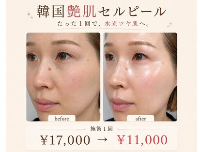 アルルプラス 南草津(ARuru+)の写真