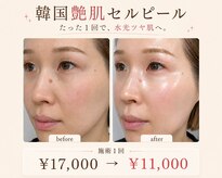 アルルプラス 南草津(ARuru+)