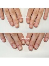 アーティネイルズ(Aaty Nails)/深爪が再発しないプログラム