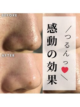 オリオンドットエスツー(Orion.S2)/【Before→After】