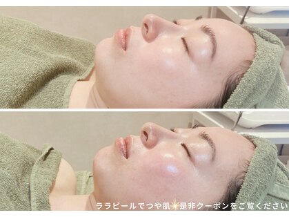 リムビューティー 自由が丘(RymBeauty)の写真