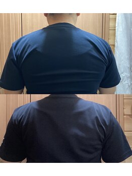 カイロプラクティック ネクサス/ストレートネックと頭痛撃退☆