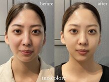 リノコロレ(ino.colore')/【人気No.1小顔コルギ】×10回