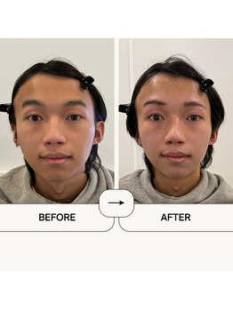 ムーンストーン(Moonstone)/眉ワックス脱毛