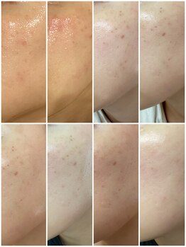トゥジュール イエリック(Toujours ierik)/老化肌へアプローチ