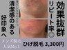 メンズヒゲ脱毛！！毎日のヒゲ剃り、貴方はまだ続ける？￥11000→￥3,300
