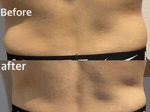 ボヌールデソワ(Bonheur de Soi)/痩身エステ