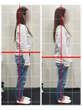 フィットリカバリー(FITリカバリー)/姿勢の変化　施術前後