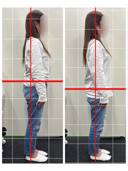 フィットリカバリー(FITリカバリー)/姿勢の変化 施術前後