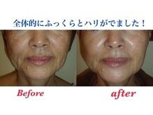 アイリスエステサロン 那覇小禄店の雰囲気（何歳からでも遅くありません。定期的なケアで綺麗になれます。）