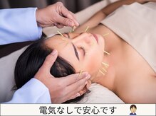 たか鍼灸接骨院/【小顔効果・眼精疲労に】美容鍼
