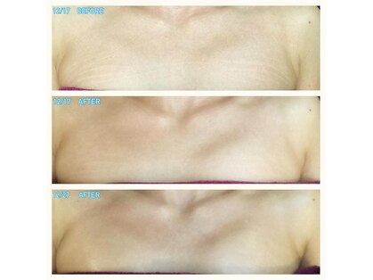 オータンティック(Authentique)の写真