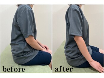 七つ葉鍼灸接骨院/ビフォーアフター【骨盤矯正】